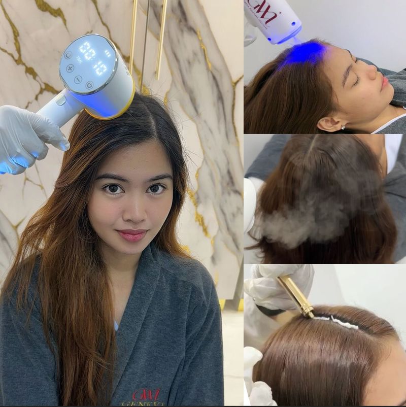 Scalp Psoriasis Therapy at Geneva Wellness